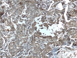 S100A10 Rabbit anti-Human, Mouse, Rat, Polyclonal, Proteintech 150 &mu;L;