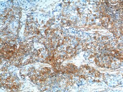 S100A10 Rabbit anti-Human, Mouse, Rat, Polyclonal, Proteintech 150 &mu;L;