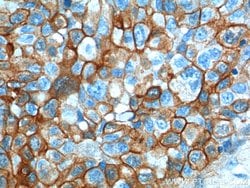 S100A10 Rabbit anti-Human, Mouse, Rat, Polyclonal, Proteintech 150 &mu;L;