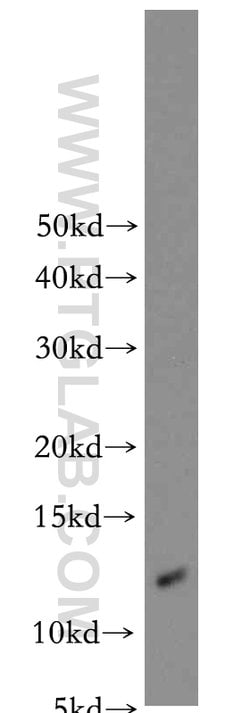 S100A10 Rabbit anti-Human, Mouse, Rat, Polyclonal, Proteintech 150 &mu;L;