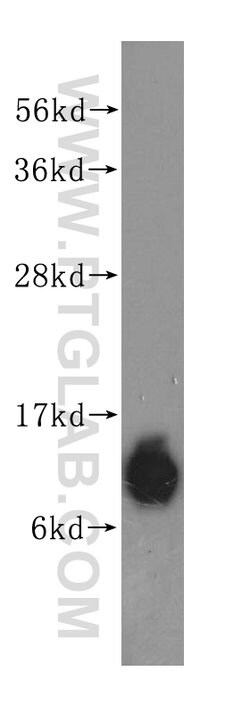 S100A10 Rabbit anti-Human, Mouse, Rat, Polyclonal, Proteintech 150 &mu;L;