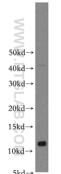 S100A10 Rabbit anti-Human, Mouse, Rat, Polyclonal, Proteintech 150 &mu;L;