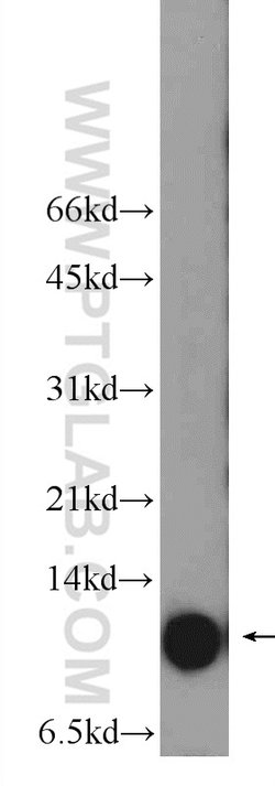 S100A10 Rabbit anti-Human, Mouse, Rat, Polyclonal, Proteintech 150 &mu;L;