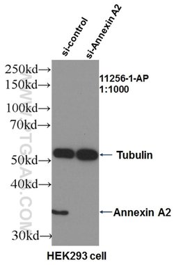 Annexin A2 Rabbit anti-Human, Mouse, Rat, Polyclonal, Proteintech 150 &mu;L;
