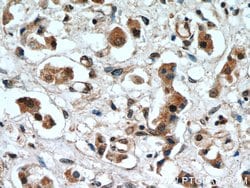 ERK1/2 Rabbit anti-Human, Mouse, Polyclonal, Proteintech 20 &mu;L; Unconjugated:Anticuerpos