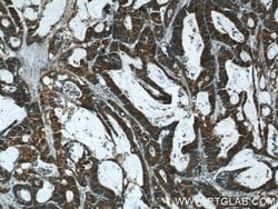 ERK1/2 Rabbit anti-Human, Mouse, Polyclonal, Proteintech 20 &mu;L; Unconjugated:Anticuerpos