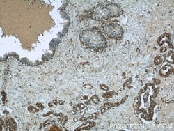 ERK1/2 Rabbit anti-Human, Mouse, Polyclonal, Proteintech 20 &mu;L; Unconjugated:Anticuerpos