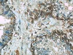 ERK1/2 Rabbit anti-Human, Mouse, Polyclonal, Proteintech 20 &mu;L; Unconjugated:Anticuerpos