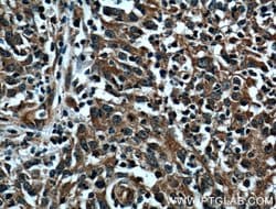 ERK1/2 Rabbit anti-Human, Mouse, Polyclonal, Proteintech 20 &mu;L; Unconjugated:Anticuerpos