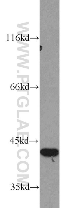 ERK1/2 Rabbit anti-Human, Mouse, Polyclonal, Proteintech 20 &mu;L; Unconjugated:Anticuerpos