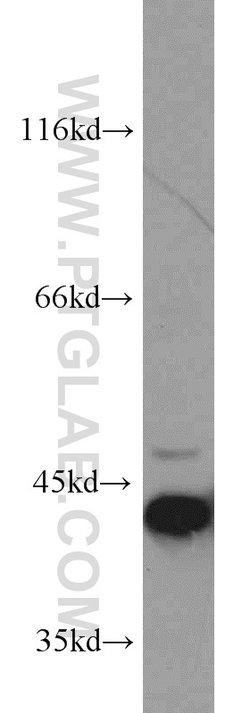 ERK1/2 Rabbit anti-Human, Mouse, Polyclonal, Proteintech 20 &mu;L; Unconjugated:Anticuerpos