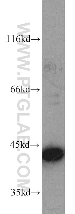 ERK1/2 Rabbit anti-Human, Mouse, Polyclonal, Proteintech 20 &mu;L; Unconjugated:Anticuerpos