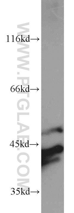 ERK1/2 Rabbit anti-Human, Mouse, Polyclonal, Proteintech 20 &mu;L; Unconjugated:Anticuerpos