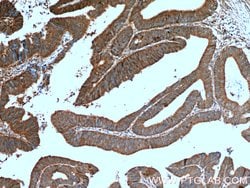 ERK1/2 Rabbit anti-Human, Mouse, Polyclonal, Proteintech 20 &mu;L; Unconjugated:Anticuerpos