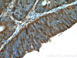 ERK1/2 Rabbit anti-Human, Mouse, Polyclonal, Proteintech 20 &mu;L; Unconjugated:Anticuerpos