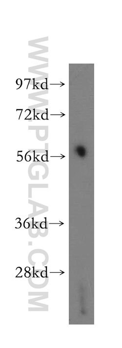 GDE1 Rabbit anti-Human, Mouse, Rat, Polyclonal, Proteintech 150 &mu;L;