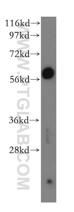 GDE1 Rabbit anti-Human, Mouse, Rat, Polyclonal, Proteintech 150 &mu;L;