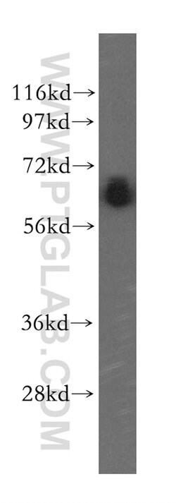GDE1 Rabbit anti-Human, Mouse, Rat, Polyclonal, Proteintech 150 &mu;L;