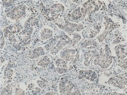 ASAH1 Rabbit anti-Human, Mouse, Rat, Polyclonal, Proteintech:Antibodies:Primary