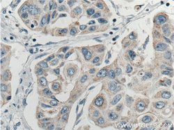 ASAH1 Rabbit anti-Human, Mouse, Rat, Polyclonal, Proteintech:Antibodies:Primary