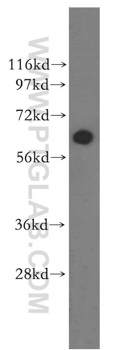 ASAH1 Rabbit anti-Human, Mouse, Rat, Polyclonal, Proteintech:Antibodies:Primary