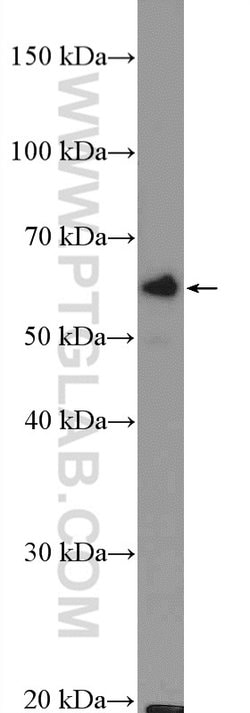 ASAH1 Rabbit anti-Human, Mouse, Rat, Polyclonal, Proteintech:Antibodies:Primary