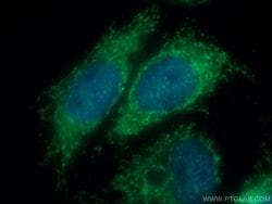 Tom22 Rabbit anti-Human, Mouse, Rat, Polyclonal, Proteintech:Antibodies:Primary