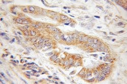 Tom22 Rabbit anti-Human, Mouse, Rat, Polyclonal, Proteintech:Antibodies:Primary