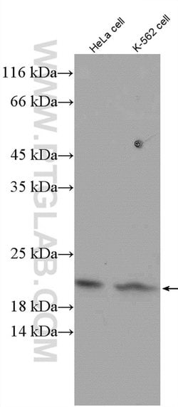 Tom22 Rabbit anti-Human, Mouse, Rat, Polyclonal, Proteintech:Antibodies:Primary