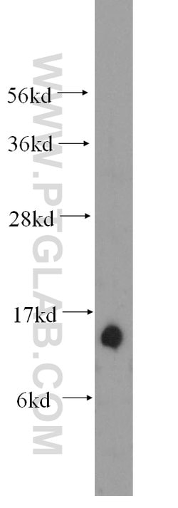 Tom22 Rabbit anti-Human, Mouse, Rat, Polyclonal, Proteintech:Antibodies:Primary