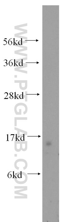 Tom22 Rabbit anti-Human, Mouse, Rat, Polyclonal, Proteintech:Antibodies:Primary