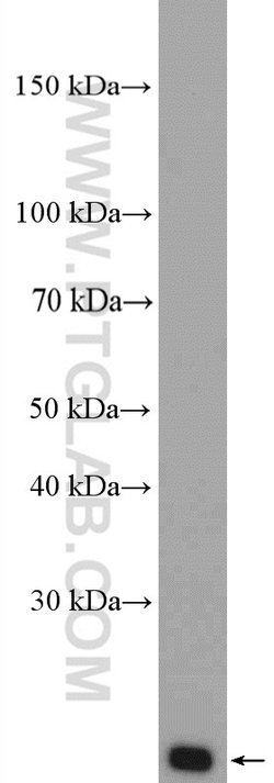 Tom22 Rabbit anti-Human, Mouse, Rat, Polyclonal, Proteintech:Antibodies:Primary