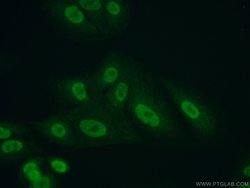PRMT1 Rabbit anti-Human, Mouse, Rat, Polyclonal, Proteintech 150 &mu;L;