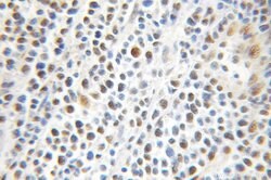 PRMT1 Rabbit anti-Human, Mouse, Rat, Polyclonal, Proteintech 150 &mu;L;
