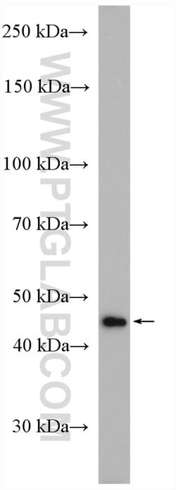 PRMT1 Rabbit anti-Human, Mouse, Rat, Polyclonal, Proteintech 150 &mu;L;
