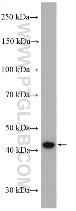 PRMT1 Rabbit anti-Human, Mouse, Rat, Polyclonal, Proteintech 150 &mu;L;