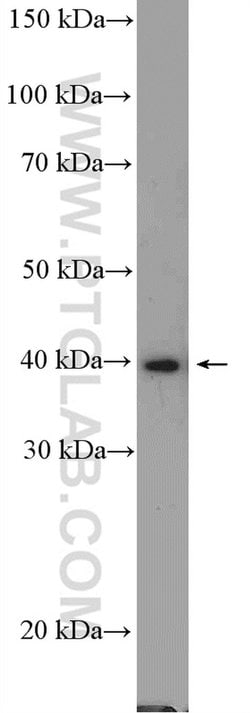 PRMT1 Rabbit anti-Human, Mouse, Rat, Polyclonal, Proteintech 150 &mu;L;