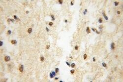 EIF4A2 Rabbit anti-Human, Mouse, Rat, Polyclonal, Proteintech:Antibodies:Primary