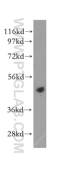 EIF4A2 Rabbit anti-Human, Mouse, Rat, Polyclonal, Proteintech:Antibodies:Primary