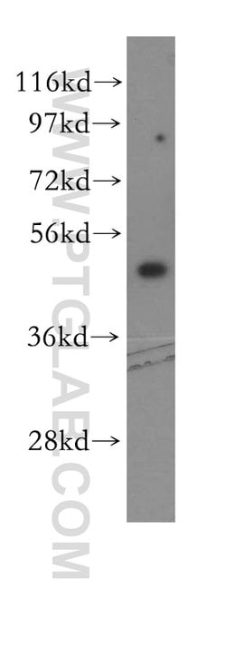 EIF4A2 Rabbit anti-Human, Mouse, Rat, Polyclonal, Proteintech
