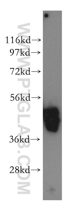 EIF4A2 Rabbit anti-Human, Mouse, Rat, Polyclonal, Proteintech:Antibodies:Primary