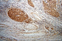 EIF4A2 Rabbit anti-Human, Mouse, Rat, Polyclonal, Proteintech:Antibodies:Primary