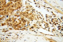 EIF4A2 Rabbit anti-Human, Mouse, Rat, Polyclonal, Proteintech:Antibodies:Primary