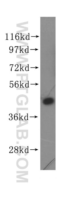EIF4A2 Rabbit anti-Human, Mouse, Rat, Polyclonal, Proteintech:Antibodies:Primary