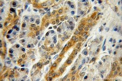 ZNF2 Rabbit anti-Human, Mouse, Rat, Polyclonal, Proteintech 150 &mu;L;