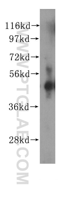 ZNF2 Rabbit anti-Human, Mouse, Rat, Polyclonal, Proteintech 150 &mu;L;