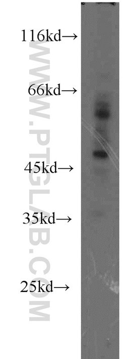 ZNF2 Rabbit anti-Human, Mouse, Rat, Polyclonal, Proteintech 150 &mu;L;