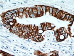 TMPRSS4 Rabbit anti-Human, Rat, Polyclonal, Proteintech 150 &mu;L; Unconjugated:Antibodies,