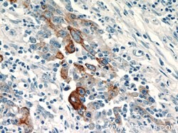 TMPRSS4 Rabbit anti-Human, Rat, Polyclonal, Proteintech 150 &mu;L; Unconjugated:Antibodies,