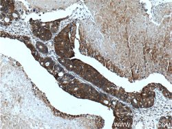 TMPRSS4 Rabbit anti-Human, Rat, Polyclonal, Proteintech 150 &mu;L; Unconjugated:Antibodies,